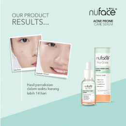 Nuface Acne Prone Care Serum 20ml